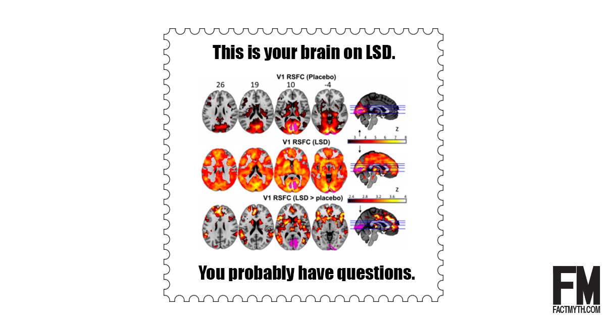 Brain on LSD
